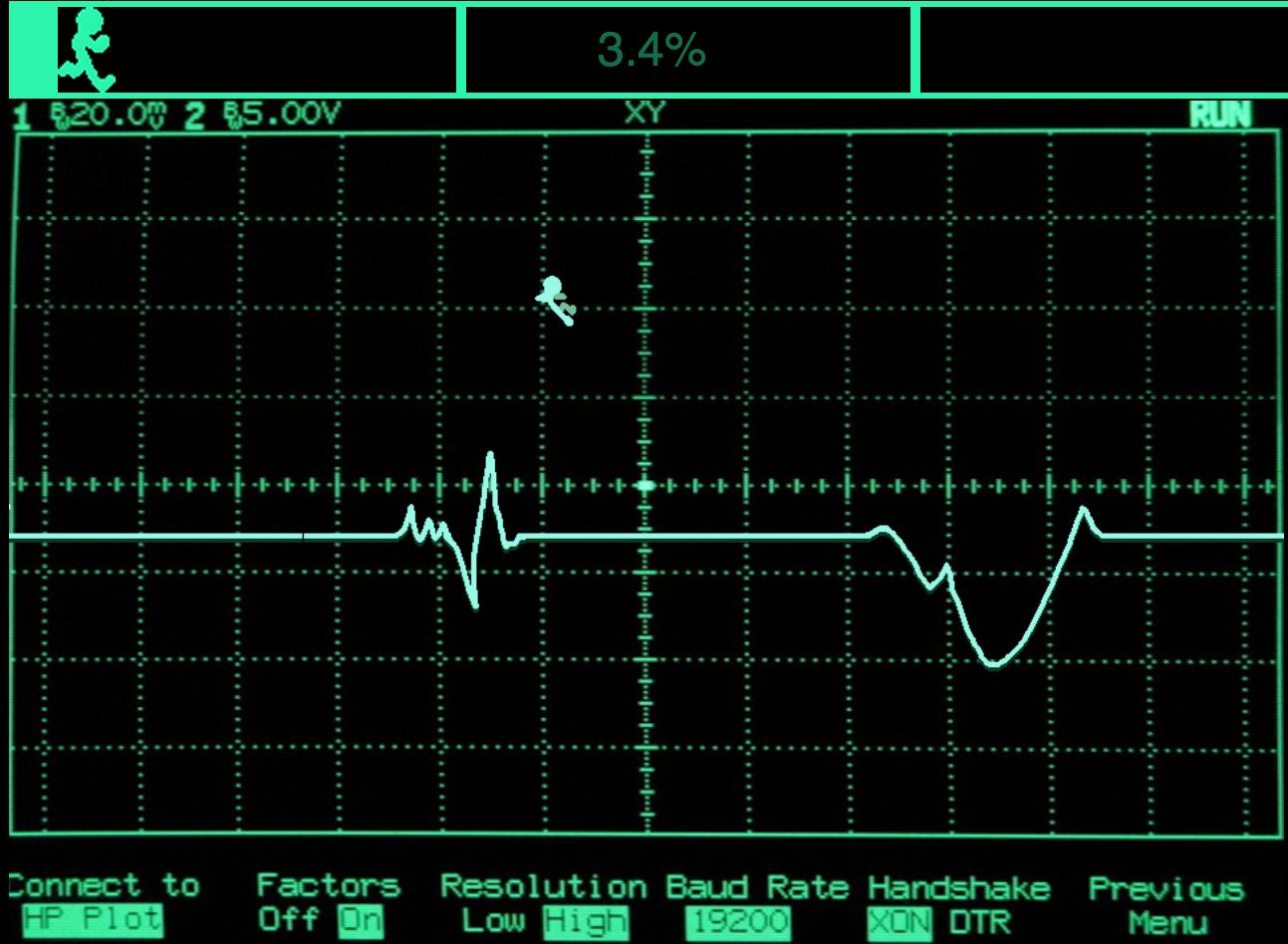 EKG Runner